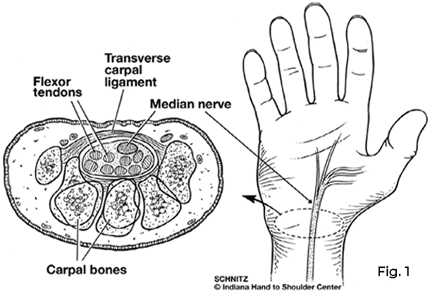 carpal tunnel contents