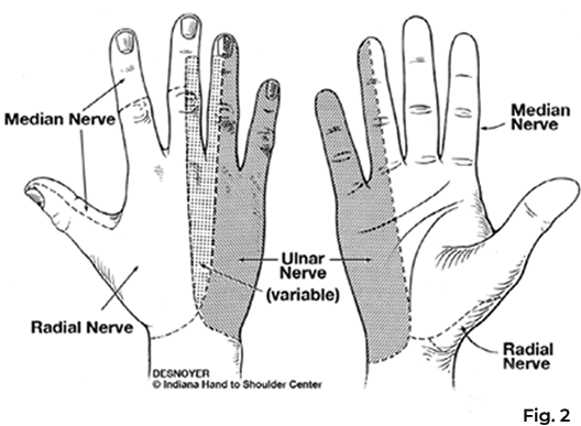 Ulnar Nerve Injuries  Hand2Shoulder Clinic