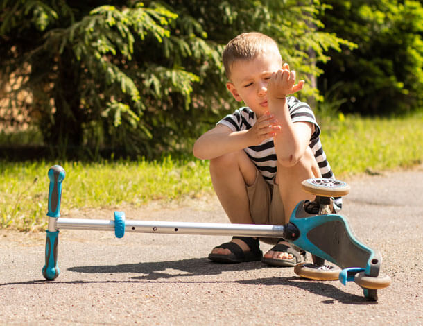 Small child with scooter and buckle fracture.