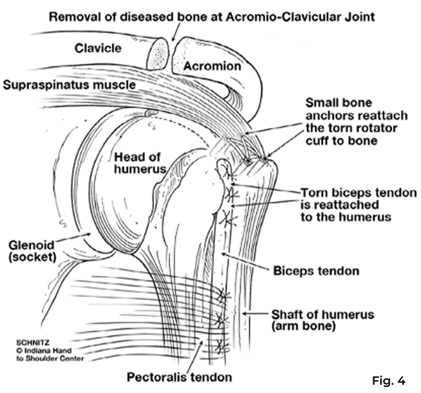 shoulder diagram