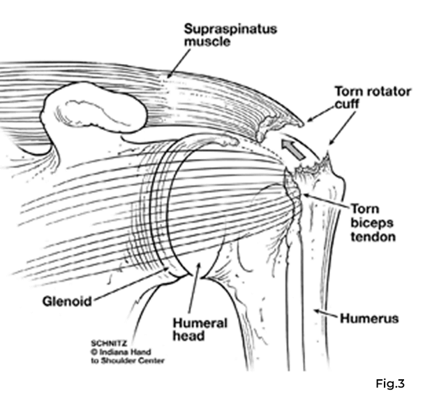 shoulder diagram