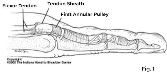 Overview of the anatomy involved in what is trigger finger